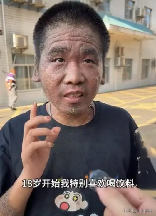 吓一跳！22岁小伙竟喝出“早衰脸”？从18岁起拿饮料当水灌，四年时间，曾经清
