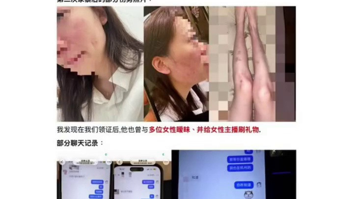 短剧白月光鹿单东家暴风波引热议