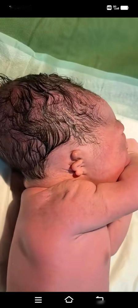 遭心，宝宝生了，宝妈气哭了，宝宝出生双耳畸形，一家人心里都不高兴了。宝爸问医生咋