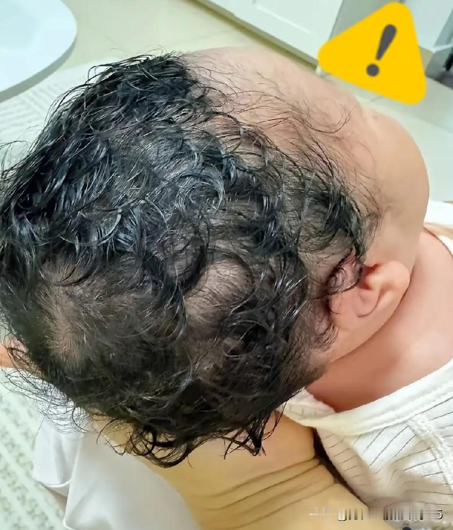 郑州市发生一起让人唏嘘的事件：孕妇剖腹产一对龙凤双胞胎，一出生就有浓密卷发，丈夫