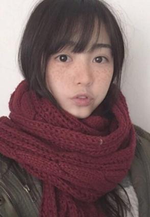 香蕉皮竟可以祛斑? 废物利用, 美白又祛斑, 绝不再做黄脸婆