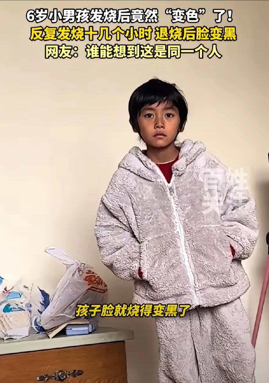 孩子发烧后，脸色黑了！家长们，要留心了。孩子身体没有恢复好中医鬼才倪海厦说过