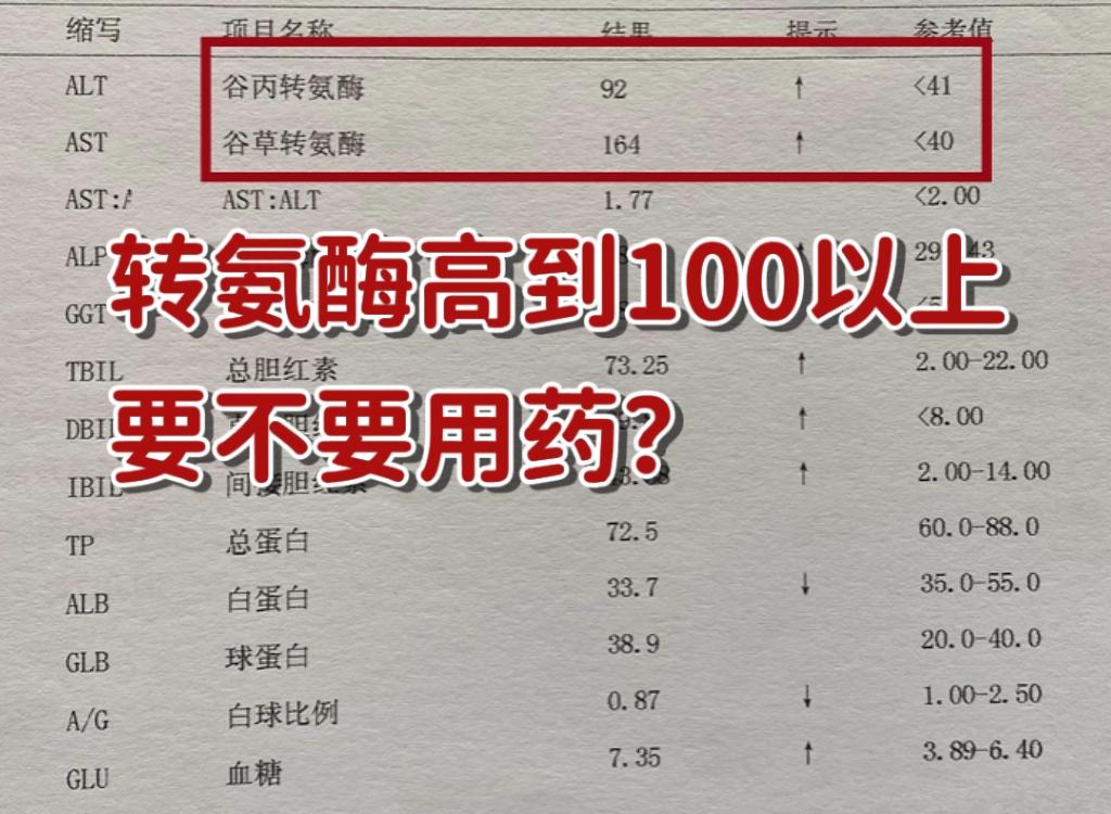 转氨酶指标到了100以上，要不要用药？首先要知道转氨酶升高到不同数值...