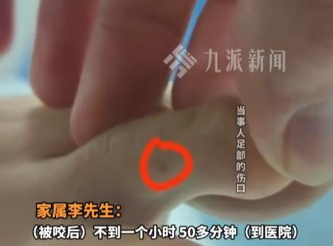 “这条命本不该丢的！”27岁女生到三亚旅游，在花坛边被毒蛇咬了一口中毒身亡！家属