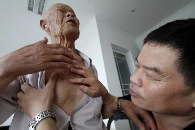 1956年，35岁农民，咳嗽10年，拒绝就医，一天，突然用力咳嗽，“哇”的一声，