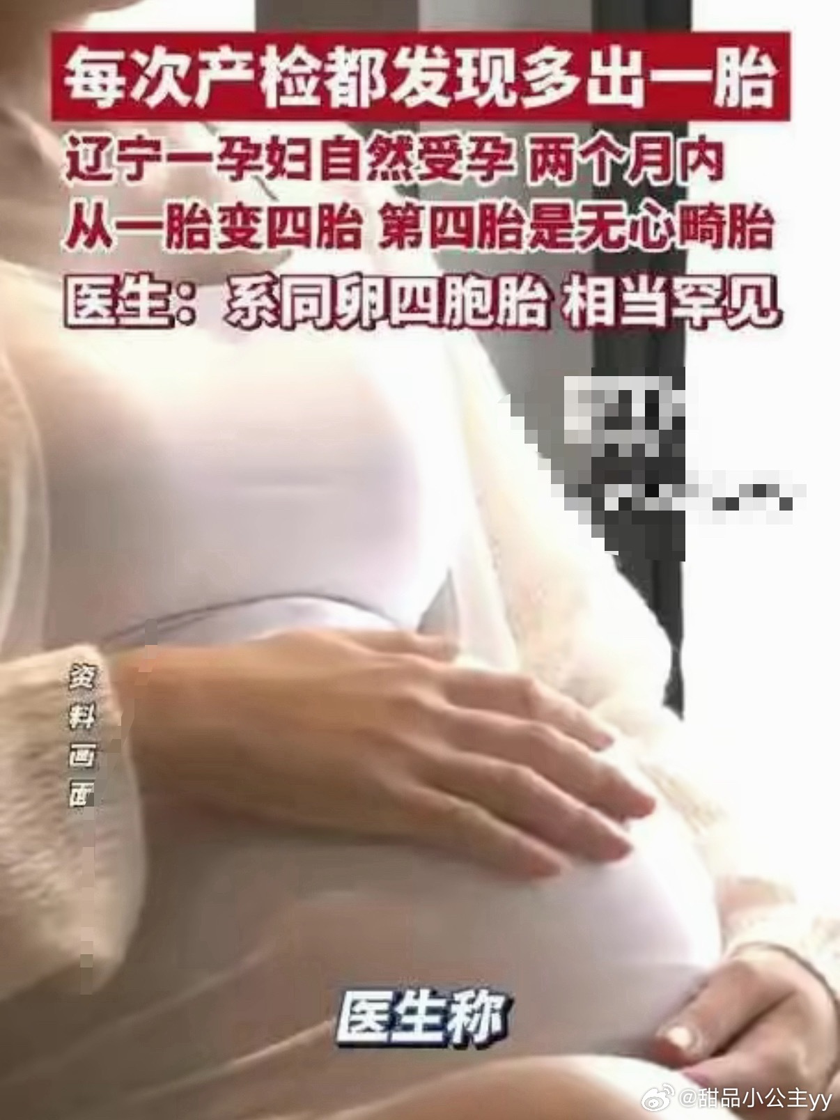 29岁宝妈回应生4胞胎罕见概率自然受孕四胞胎的概率约万分之一以上，自然顺产则更为