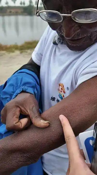 他不是死于肺，是终于把一生都“钓”完了。河北“钓帝”安国勇，75岁，前几天走了。