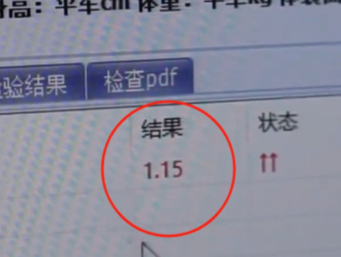 “这医院火了！”7月15日，浙江义乌，男子因胸闷到医院检查，他认为结果出来时医生