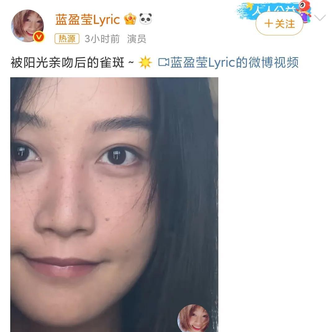 蓝盈莹大方晒雀斑，一点偶像包袱也没有呢