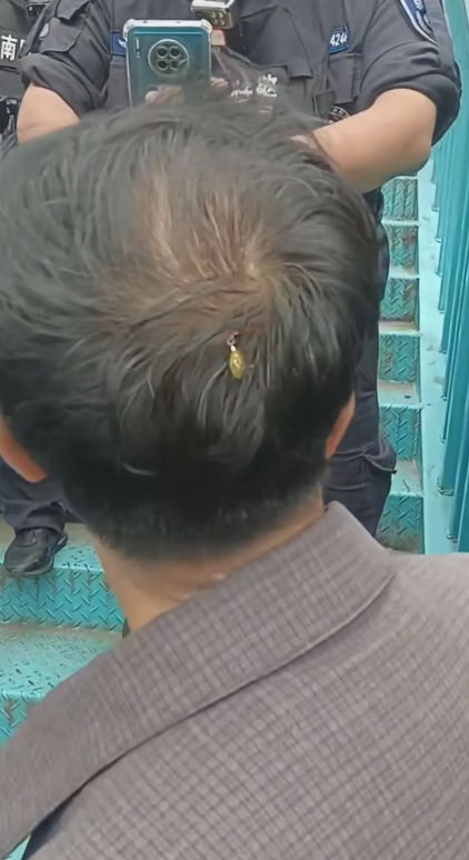 他的头上是什么挂在那？