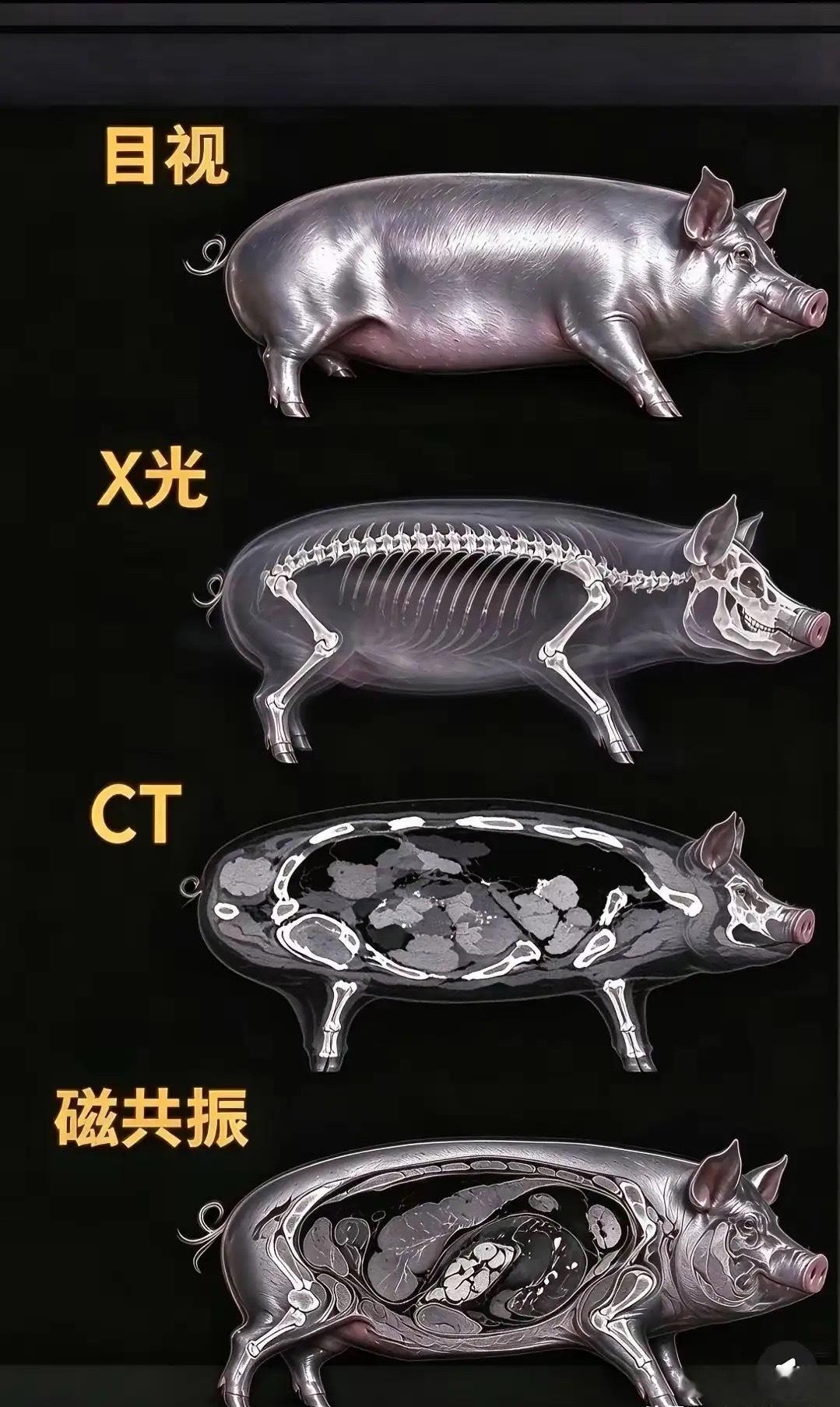 这就是为什么核磁共振这么贵​​​