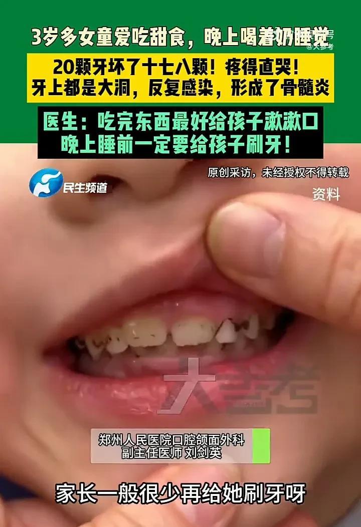 太可悲了！7月3日，河南郑州一个3岁半的女孩因牙齿痛到医院检查，医生发现她全嘴2
