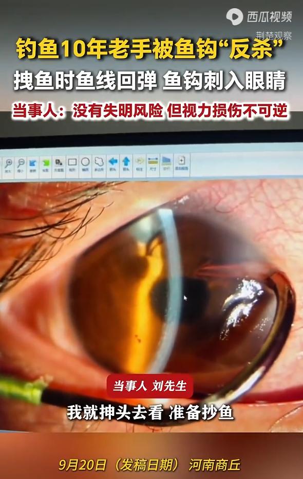 河南商丘，一位有着10年钓龄的老钓鱼佬，在浮桥上用4米5鱼竿钓黑坑时，一条鲤鱼突
