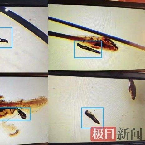 武汉56岁的刘女士最近可被折腾得够呛。退休后时间多了，她跟着网络教程学化妆，每天