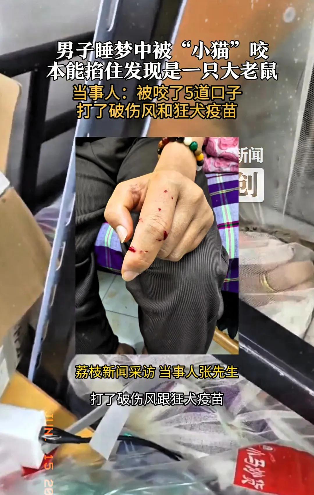 “这真是离谱！”江苏无锡的张先生半夜被一阵剧痛惊醒，原来睡梦中搂住的“宠