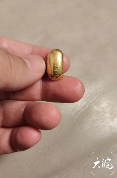 10克金豆惊险过肠6天！妈妈每天叮嘱：这泡屎很贵，憋回家拉