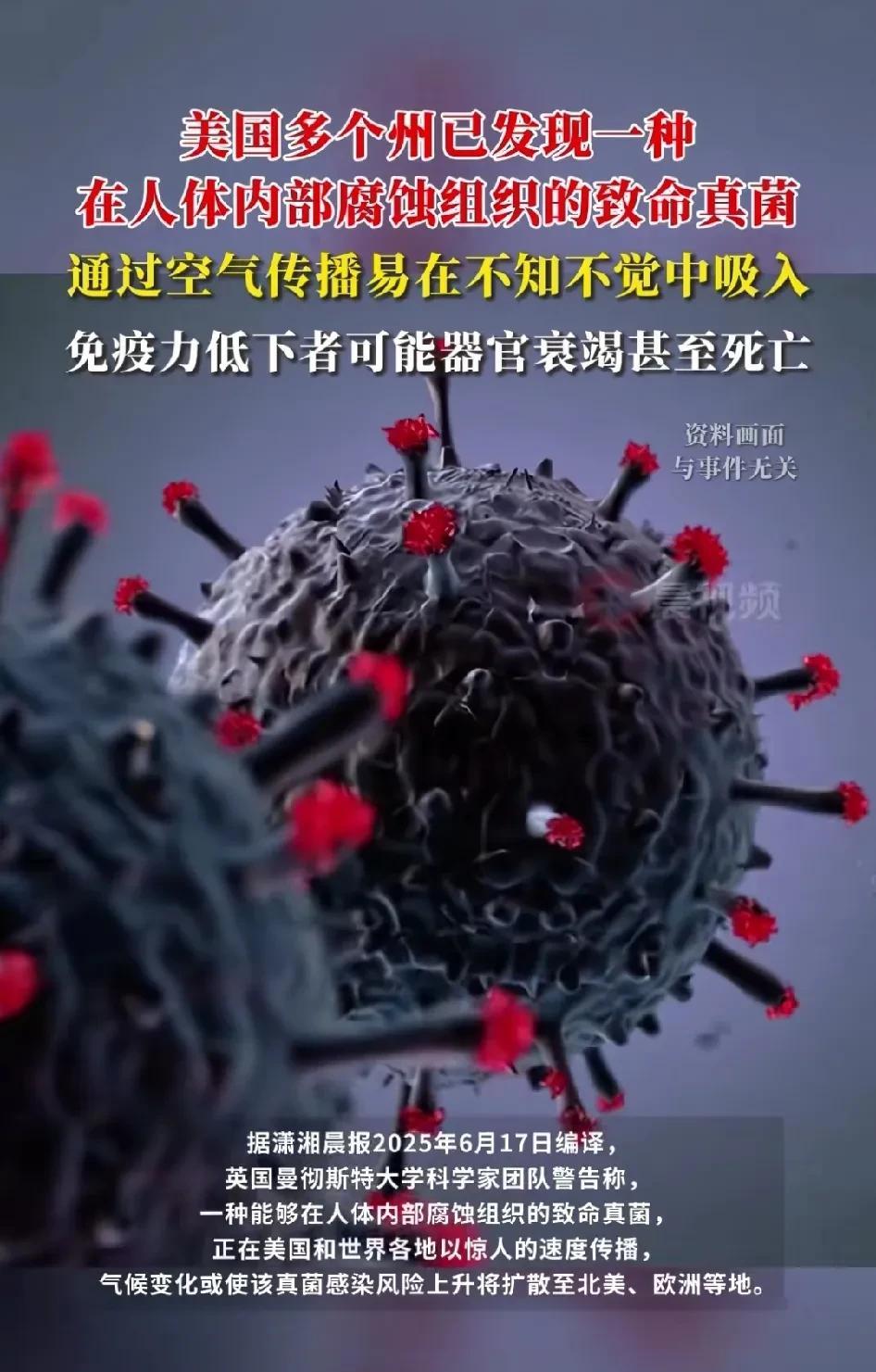 真不建议国乒队运动员去美国拉斯维加斯打美国大满贯赛了。不仅仅是因为目前美国洛杉矶