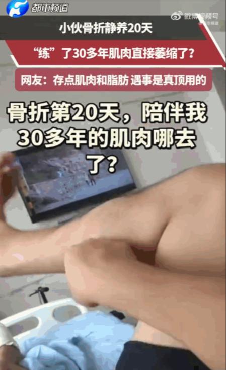 河南一小伙骨折后躺床静养，不料短短20天，练了30年的精壮小腿竟萎缩成了“肥肉”