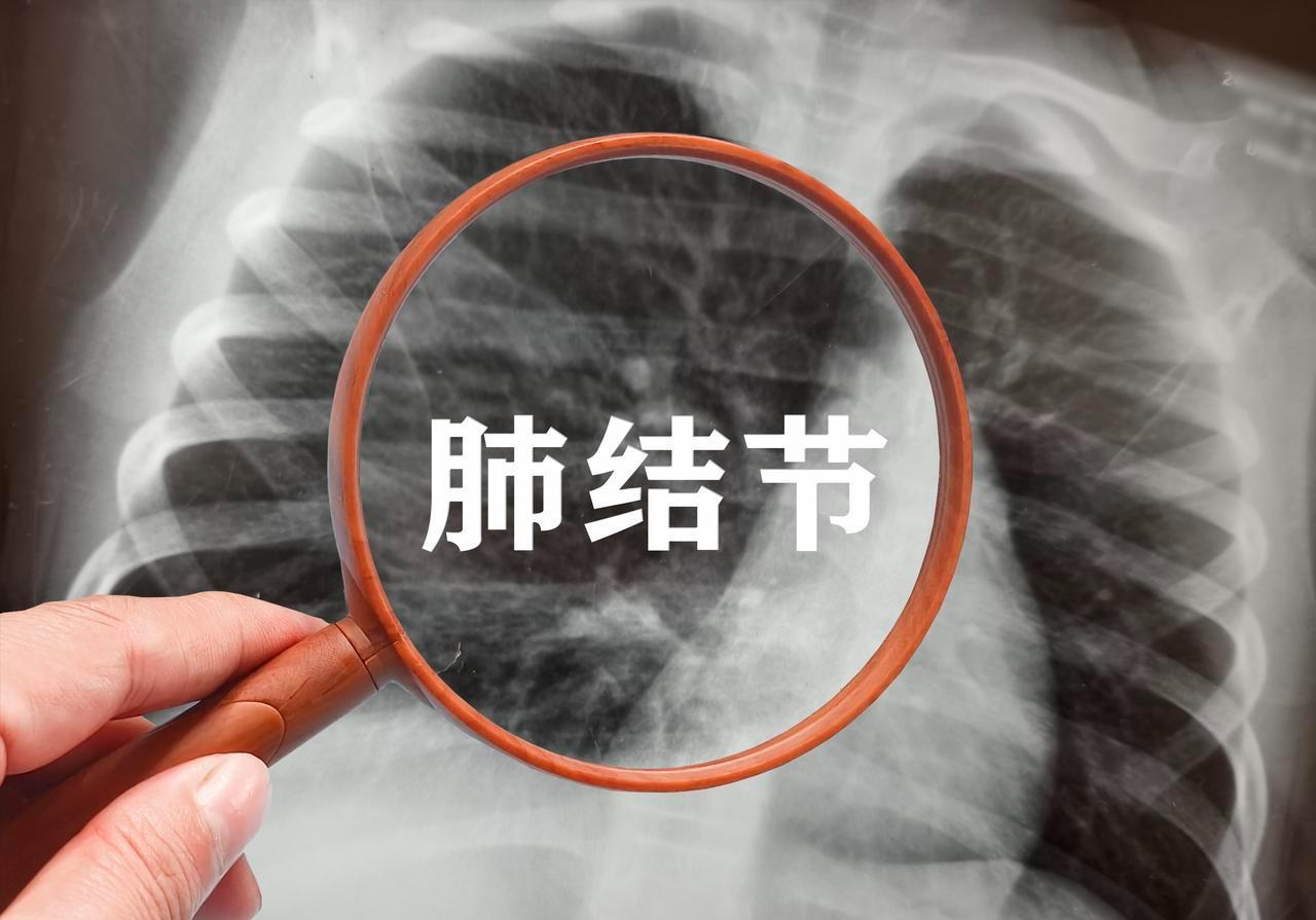 恶性结节药物消不掉可以理解,为什么大部分良性结节也消不掉用药消掉肺部结节是一个