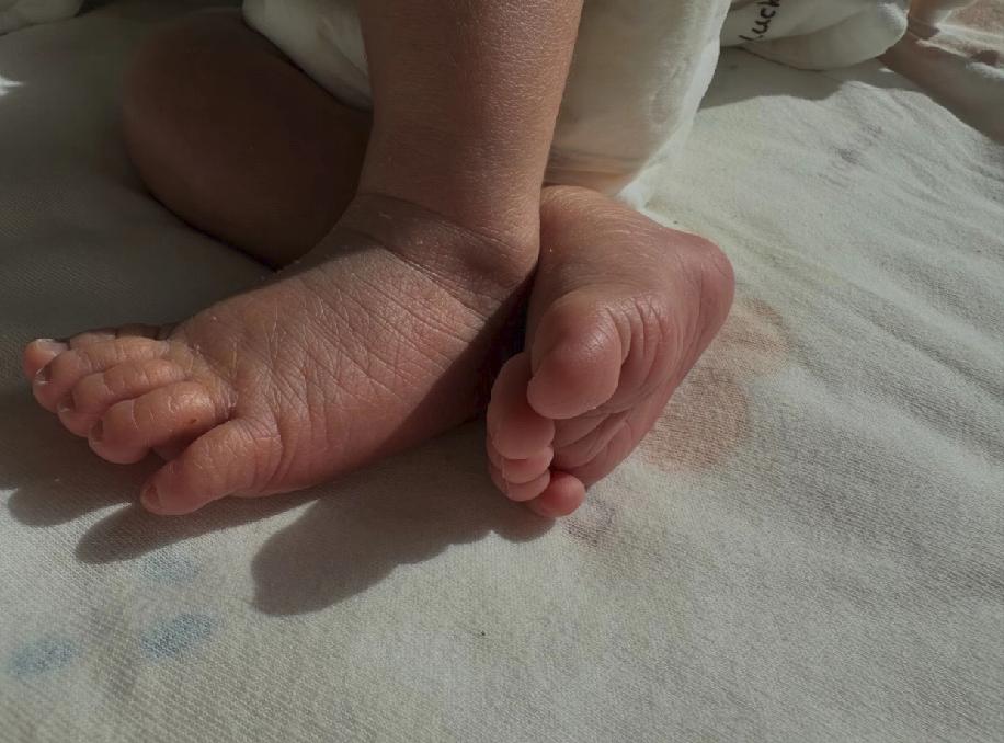 从未想过，生完孩子要克服的第一个问题不是睡不了整觉，也不是熬不完的夜，而是生理性