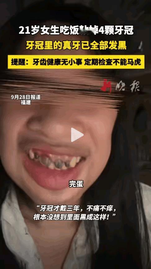 天塌啦！不仅福建知道了，全国都知道了！福建一年仅21岁的女生，吃个饭竟然掉了4