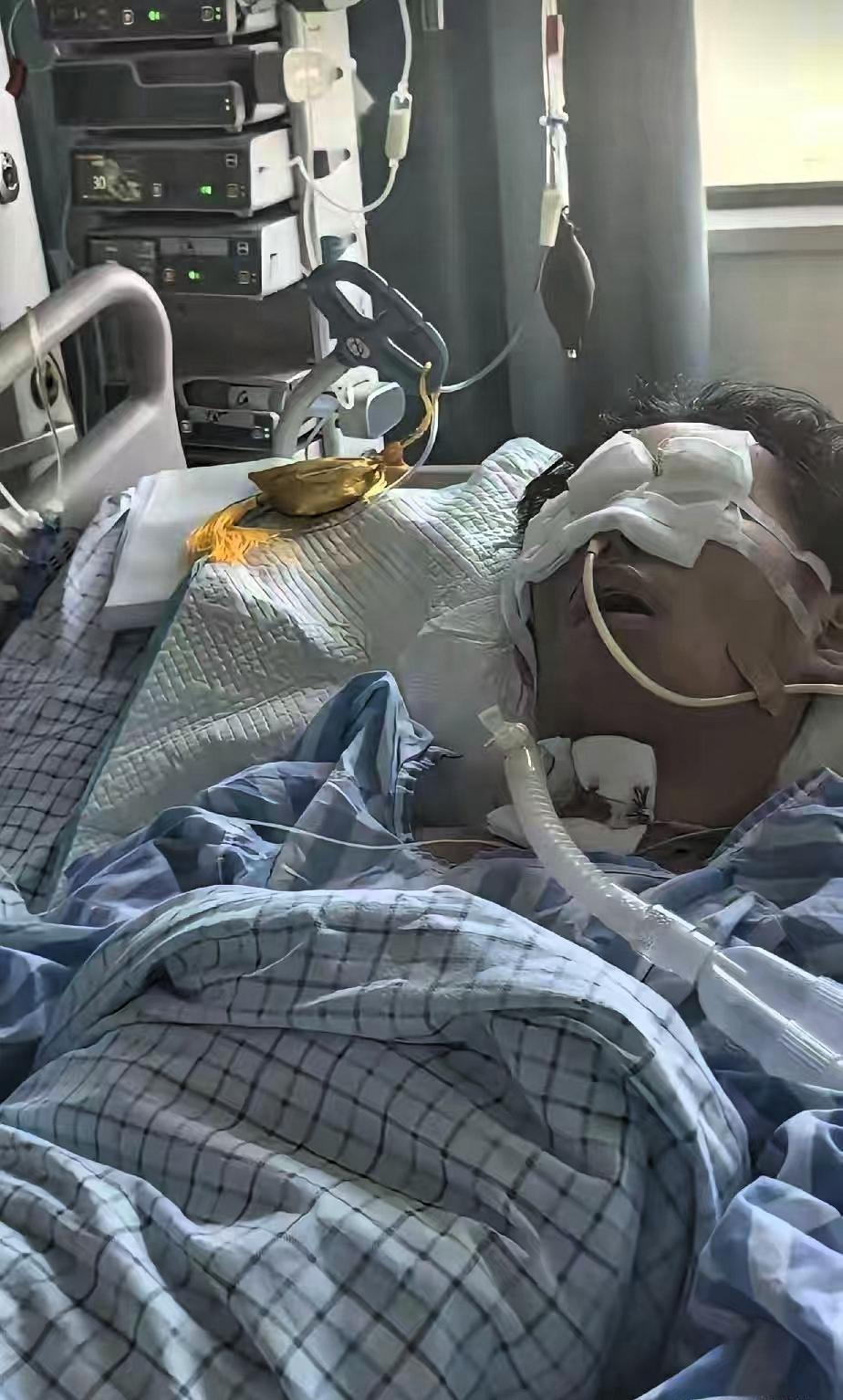 14岁陈佳铭已昏迷超30天，上海专家会诊后，确认无生还希望安徽蚌埠14岁的