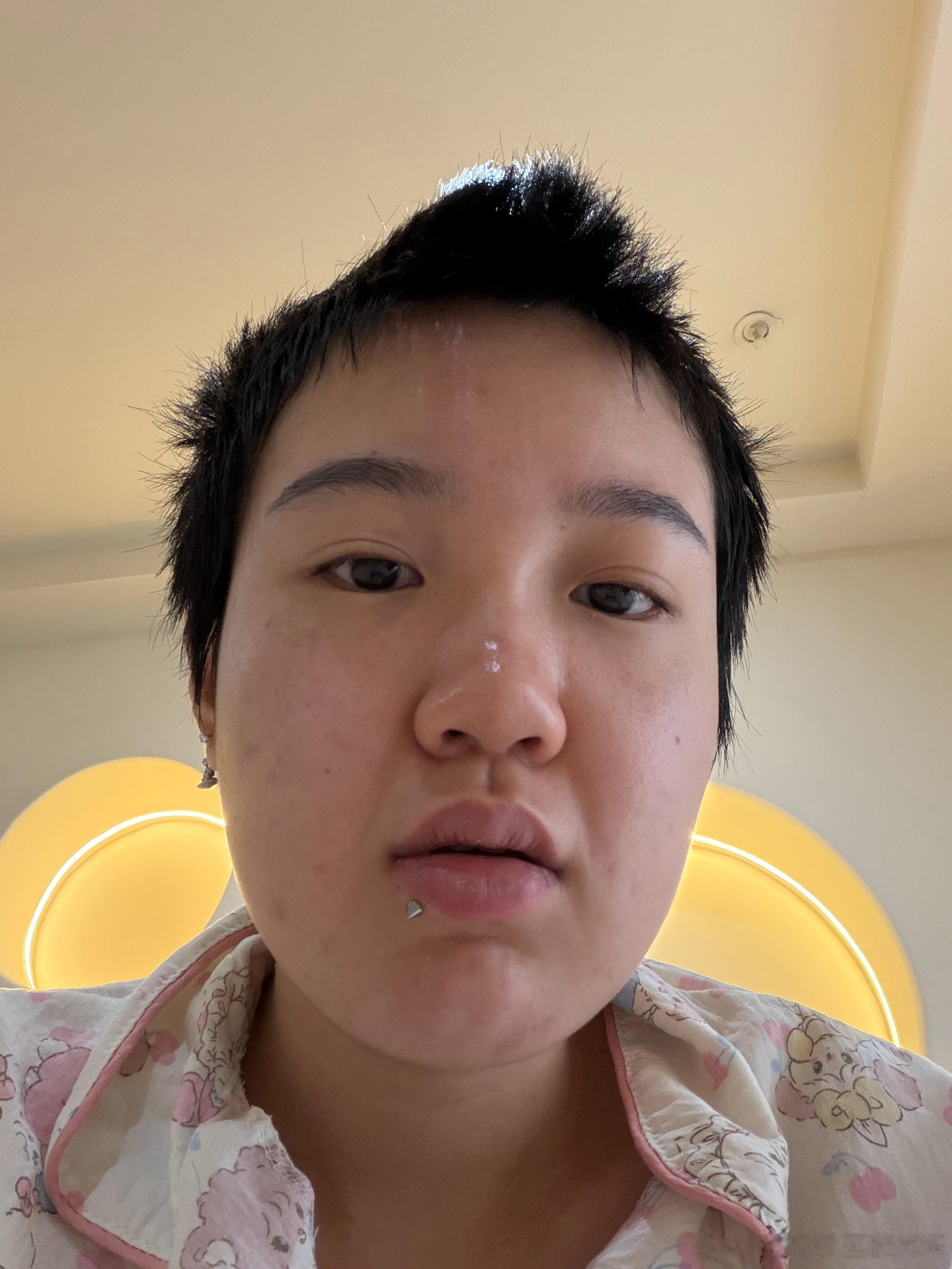 挑战世界第一水肿脸体质​​​