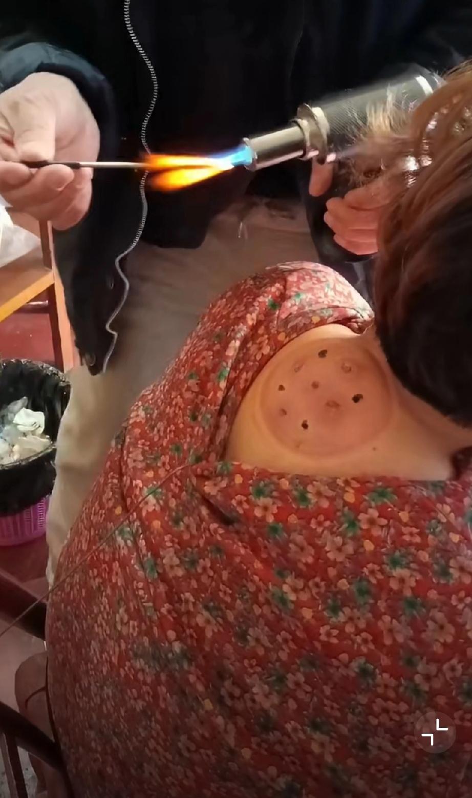 民间偏方出手太狠了，大娘这都不吭一声。。。老一辈的小偏方民间土偏方老祖宗小偏