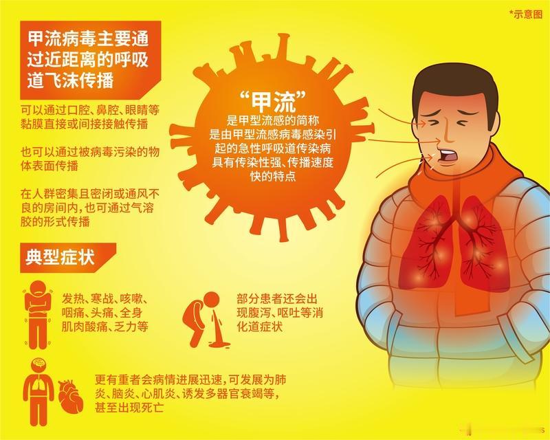 甲流有哪些并发症状呢?甲流的并发症状可不能小瞧。一般甲流经1-3天潜伏期后