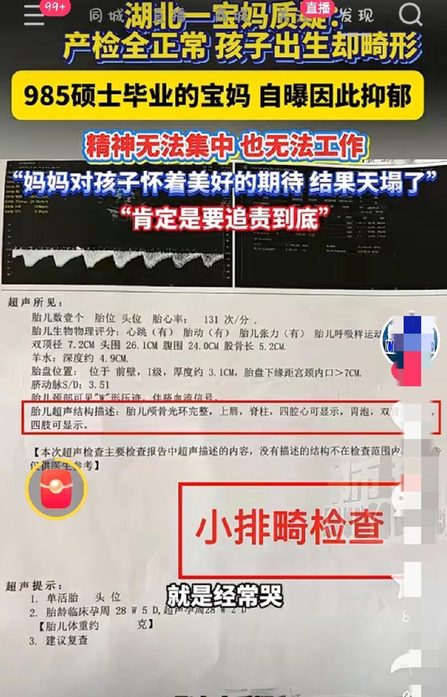天塌了！产检一切正常却生下脊柱畸形宝宝！985宝妈辛苦怀胎十月，无证操作，影像缺