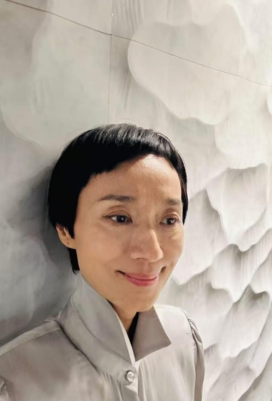 原来红斑狼疮真很凶险，周海媚因这个病离世，年仅57岁，而出演过《爱在他乡》的坣娜