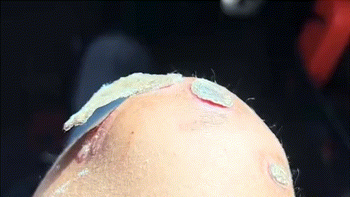 你戒毒都不用去戒毒所，自己在家随便就戒了[墨镜]