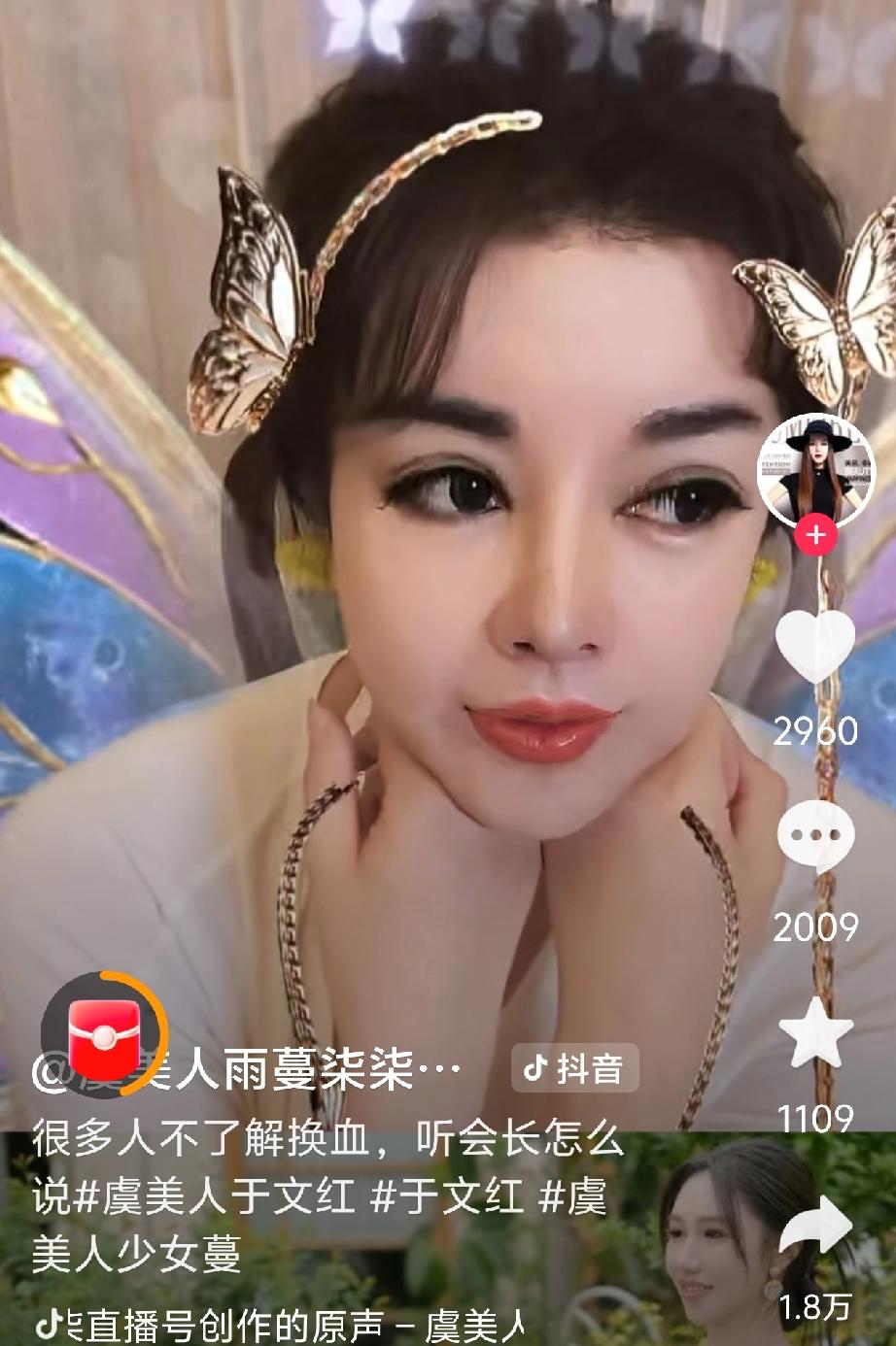 普通人救命血库告急，有钱人却拿它美容？于文红说很多很多18-21岁男孩子的血，才