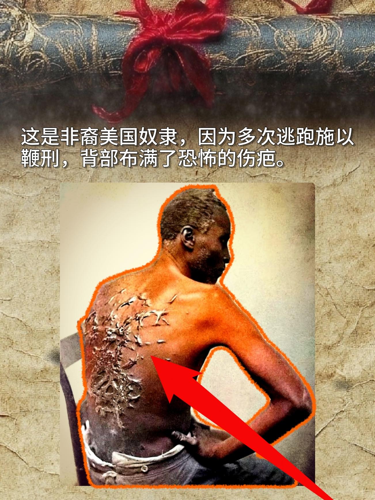 这是非裔美国奴隶，因为多次逃跑施以鞭刑，背部布满了恐怖的伤疤。