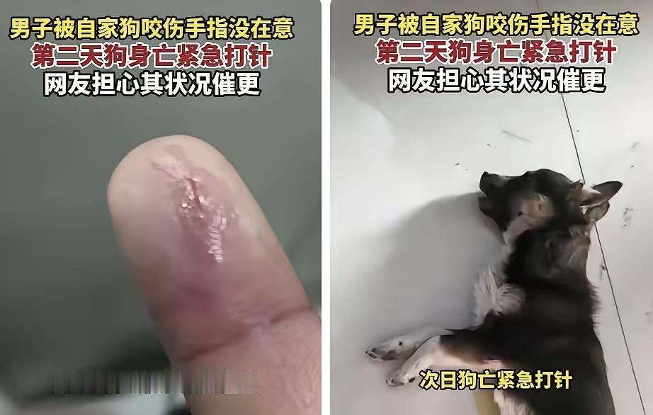 河南一男子被自家狗咬伤手指，当时只破点皮没出血，就用水冲了冲没在意。结果第二天早