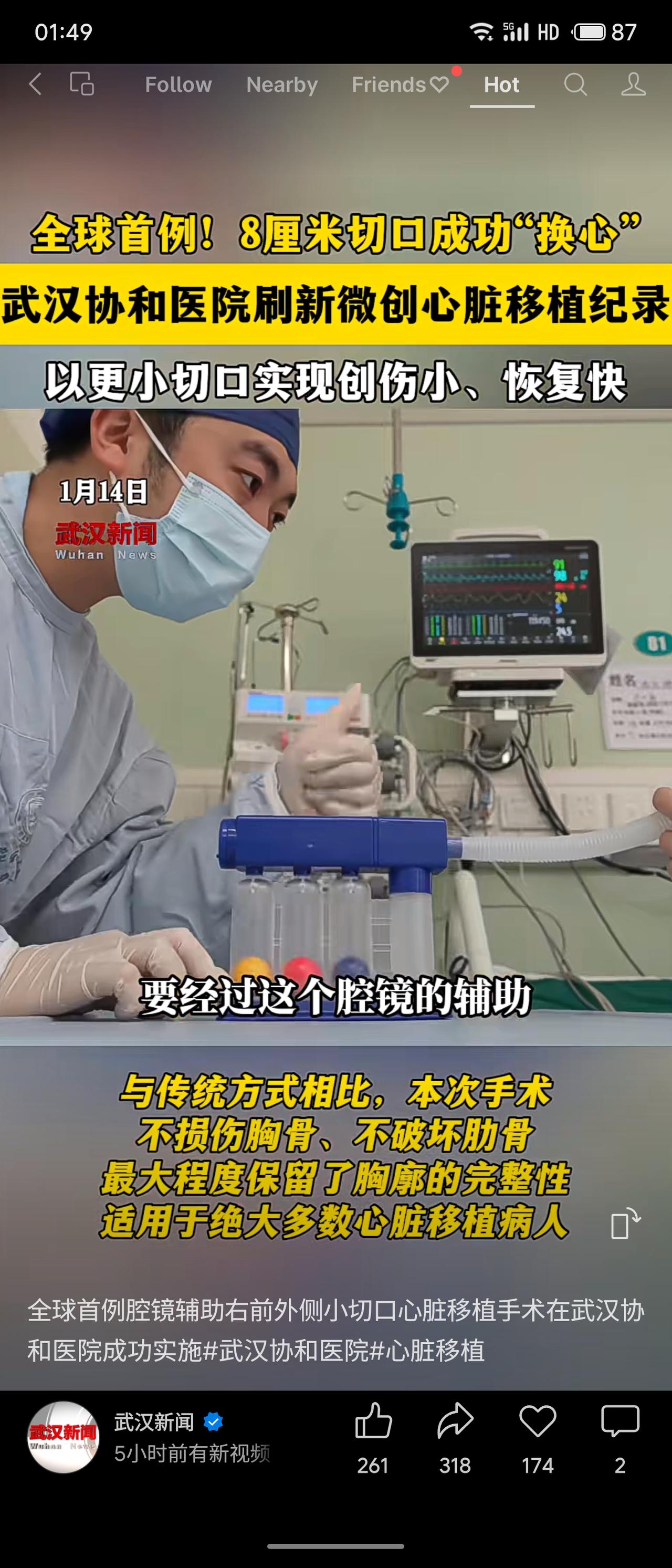 武汉协和医院董念国团队为一名53岁终末期心衰患者成功实施全球首例腔镜辅助微创心脏