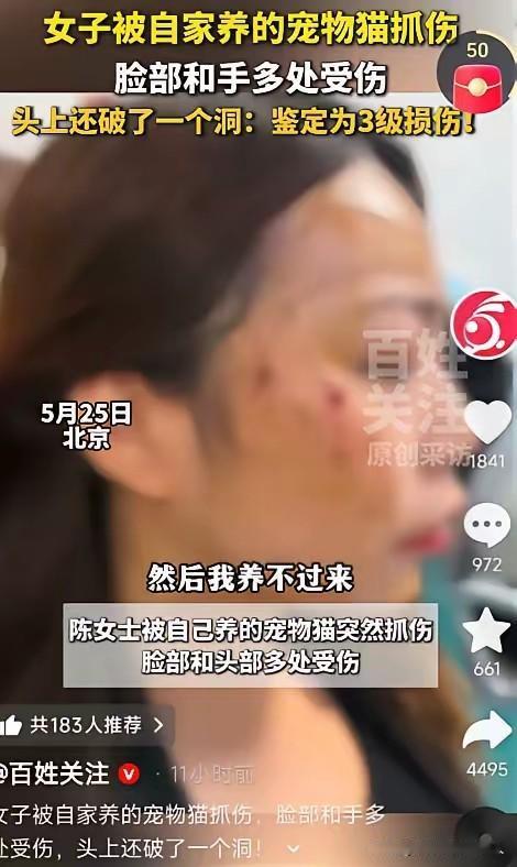 北京这位陈女士惨遭自家宠物猫突袭抓伤，头脸、手部遍布伤口，头部更是破洞受伤，伤情