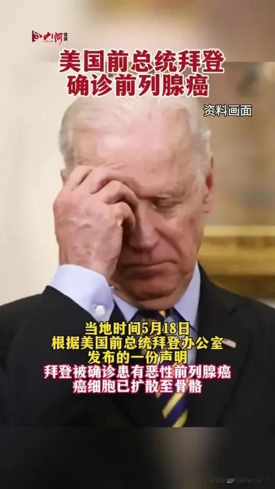 拜登被确诊为前列腺癌，那么前列腺癌有多厉害呢！如果将癌症的严重程度分成十级，十
