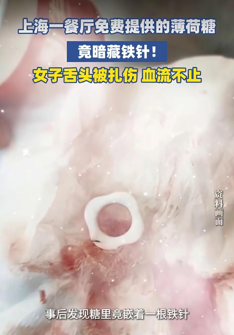 上海一妹子吃完饭，顺手拿了店里免费薄荷糖放嘴里——下一秒舌尖扎得生疼，满嘴是血。