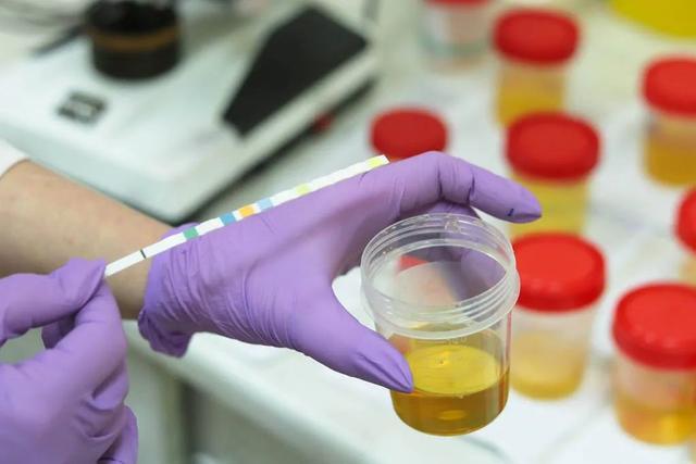 “体内有癌，大小便先知”的说法，虽然听起来有些绝对，但确实有一定道理。许多癌症，