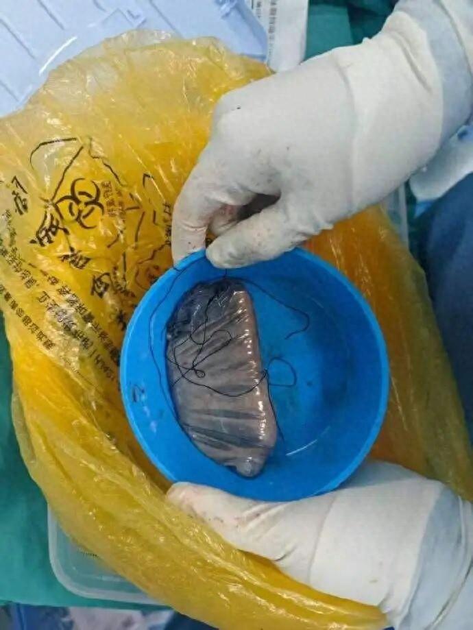 无知者无畏！重庆，一男子因为好奇，在网上买了些水银，可谁也想不到，男子购买水银后