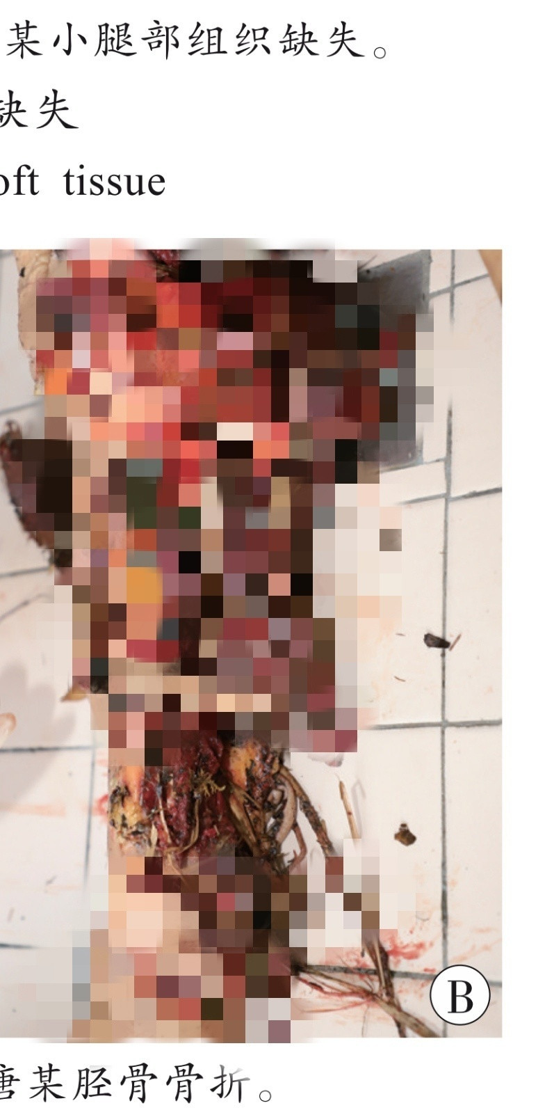 女子采摘山茱萸被黑熊从身后扑倒绝对的命大！可能是这只黑熊尚不饥饿。看过一个案例：