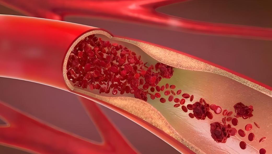 体内有淤，夜间有感觉！睡觉时若有4种不适，或是血瘀发出的信号： 你有没有试过