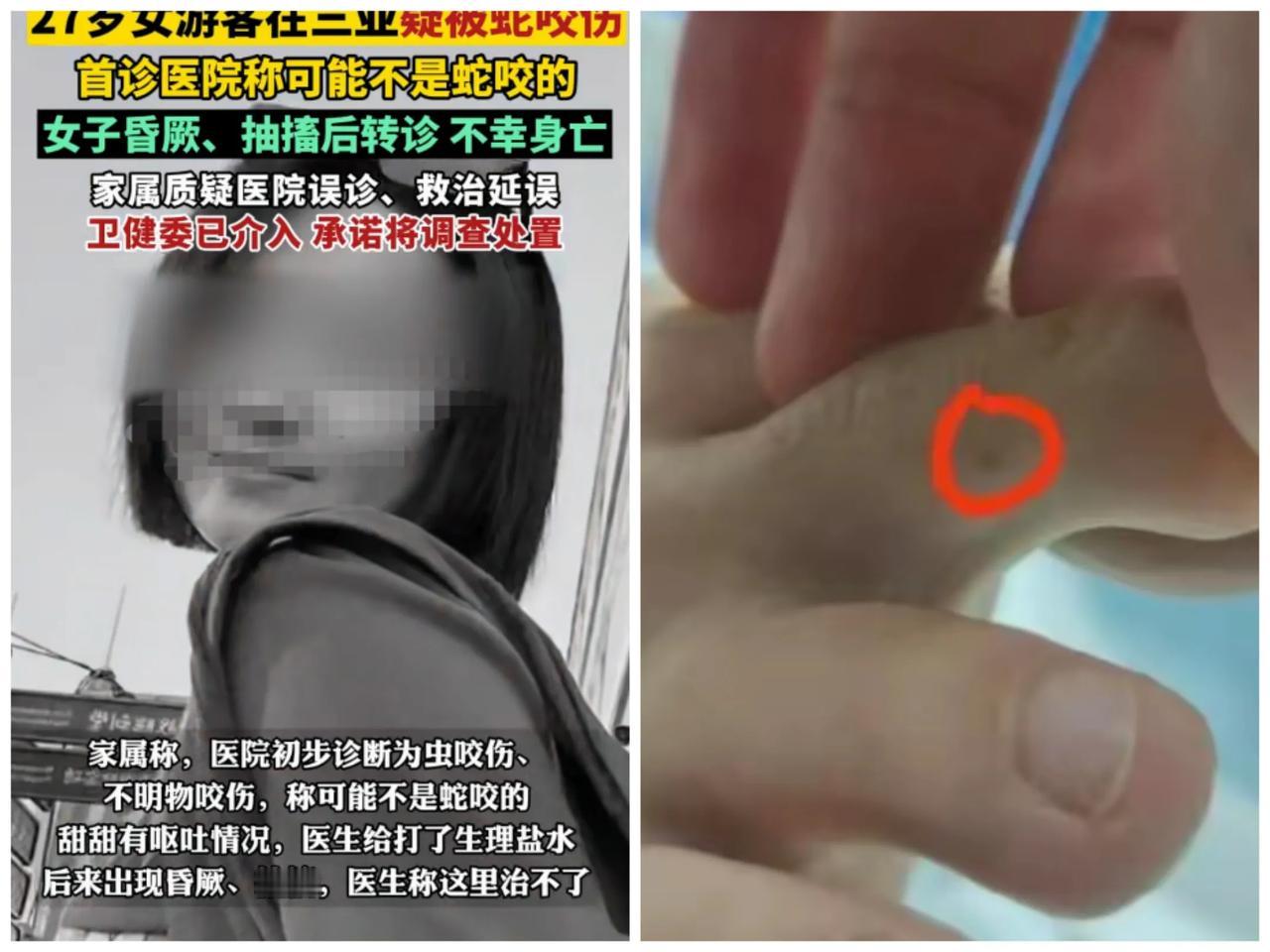 三亚女子被蛇咬伤离世一条生命引发了众多蝴蝶效应：1、多地公布了有抗毒血清的
