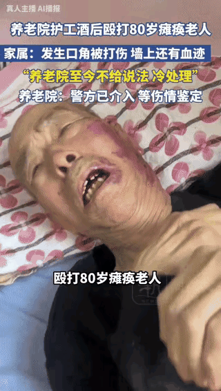 这人咋这么狠3月20日，天津南开区纳德养老院，一名护工酒后殴打80岁瘫痪老人