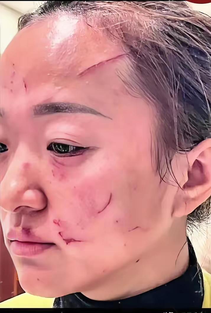 婆婆这难道是嫌儿媳长的太漂亮了？居然把九阴白骨爪都连上了，抓花还在月子里的儿媳脸