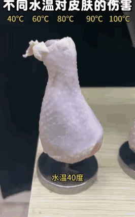 “热水对肉体的伤害有多大”建议喝温水，不要喝40度以上的烫水我们都是肉长的