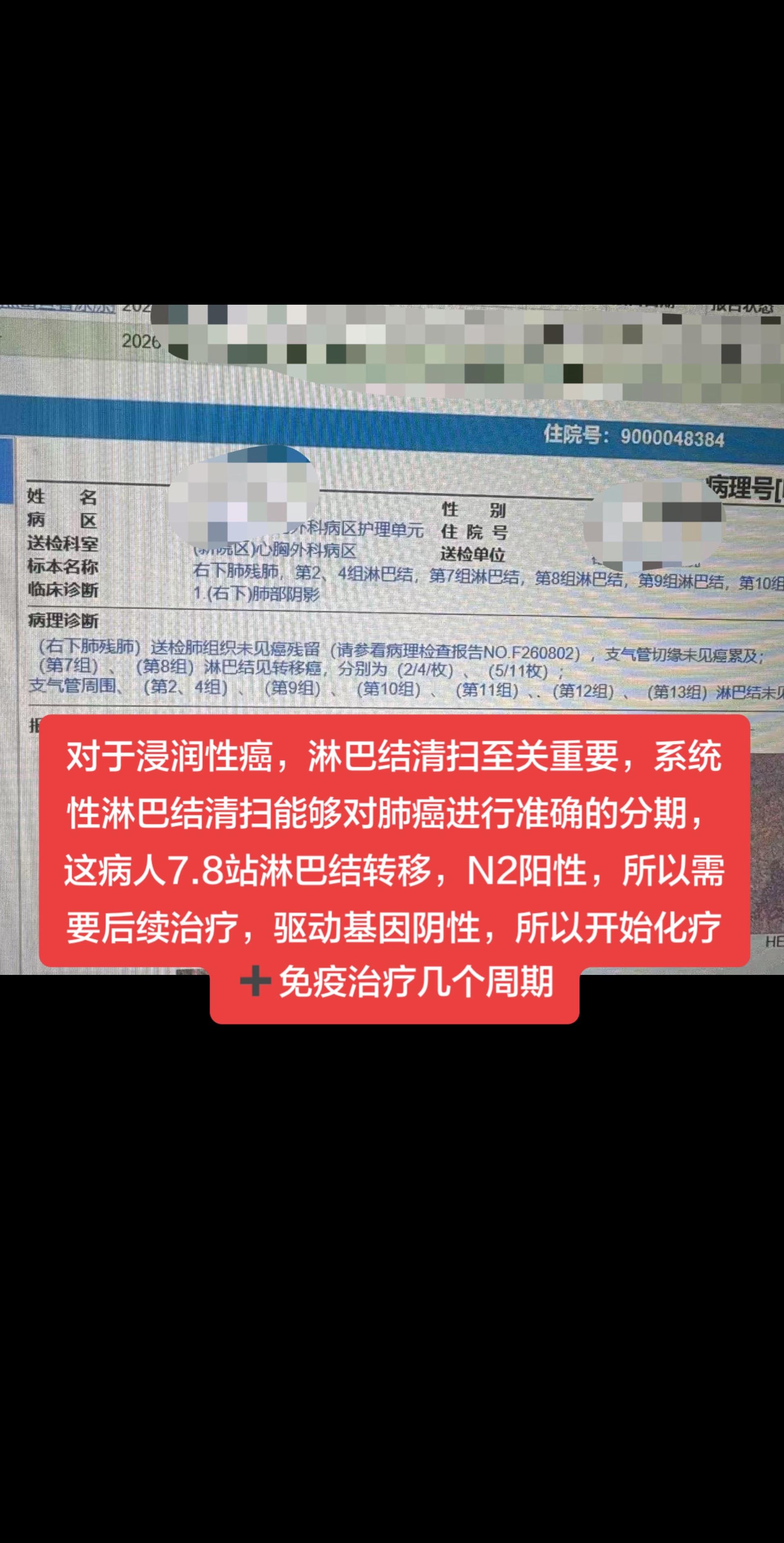 对于浸润性癌，淋巴结清扫至关重要，系统性淋巴结清扫能够对肺癌进行准确的...