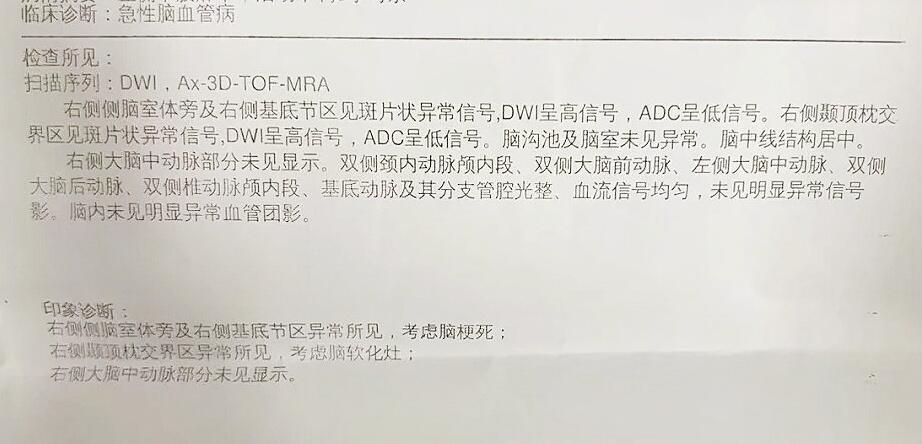 29岁确诊脑梗天塌了​​​