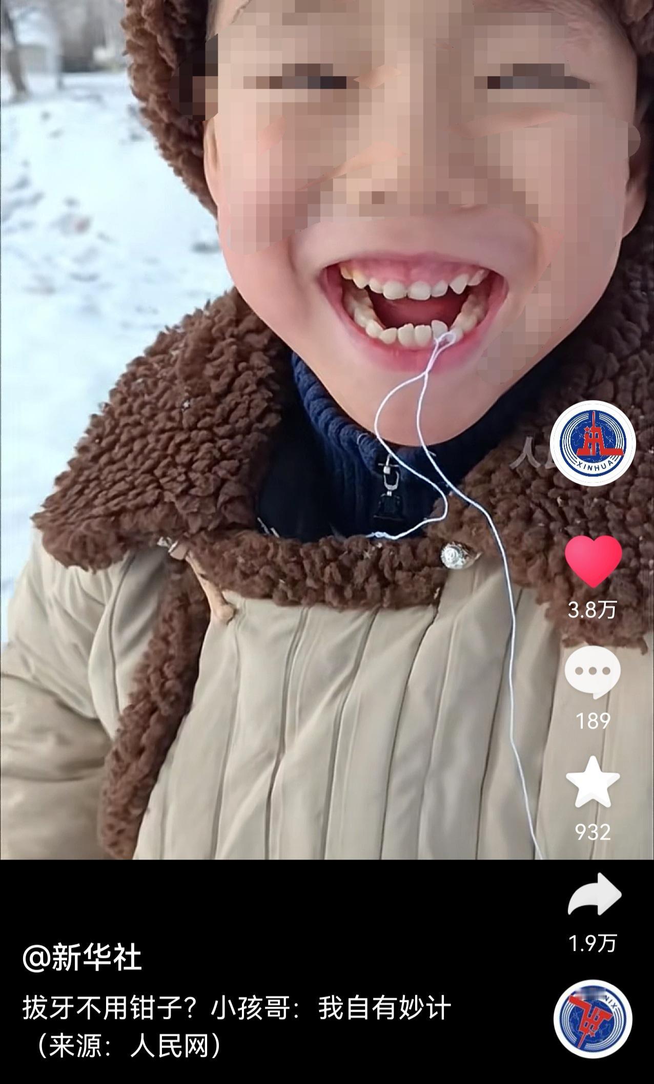 我的妈呀，小孩哥的拔牙用弓箭的拔，小孩哥的拔牙创新，还是挺牛的[大笑][大笑][